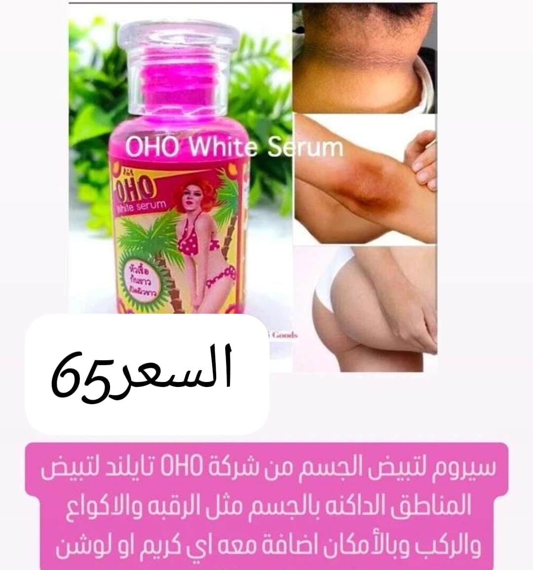 سيروم التبييض من  OHO